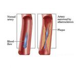 USA Vascular Centers, Hialeah