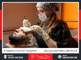 Profile Photos of Camilia Clinic Hair Transplant in Turkey
