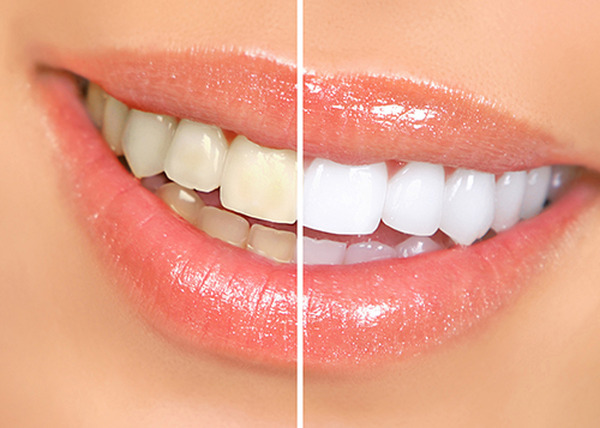  Profile Photos of Josey Lane Dentistry 2440 N Josey Ln #102 - Photo 2 of 12