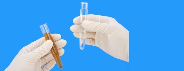  Profile Photos of Arbro Pharmaceuticals Ltd. 4/9 Kirti Nagar Industrial Area New Delhi  India 110015 - Photo 15 of 15