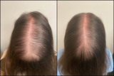  TM Hair 4848 Loop Central Dr #550 