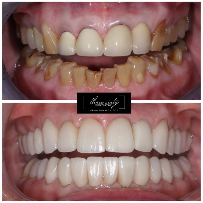  New Album of Three Sixty Dentistry: Brian Edwards DDS, Amanda Jenney DDS & Stephani 23504 Lyons Ave #104 - Photo 2 of 6