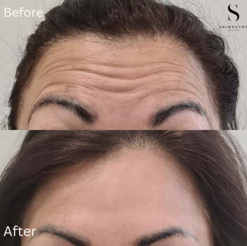  Profile Photos of SkinSutra Med Spa 1011 Upper Middle Road E, Unit E6 - Photo 3 of 3