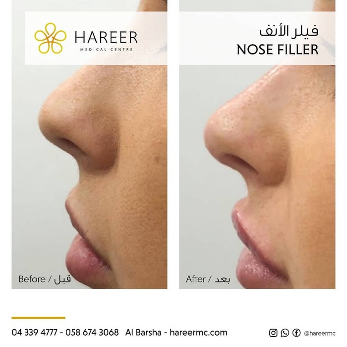  Hareer Medical Center of Hareer Dermatology Clinic The Iridium Building, Umm Suqeim St, Al Barsha, Al Barsha 1 - Photo 1 of 10
