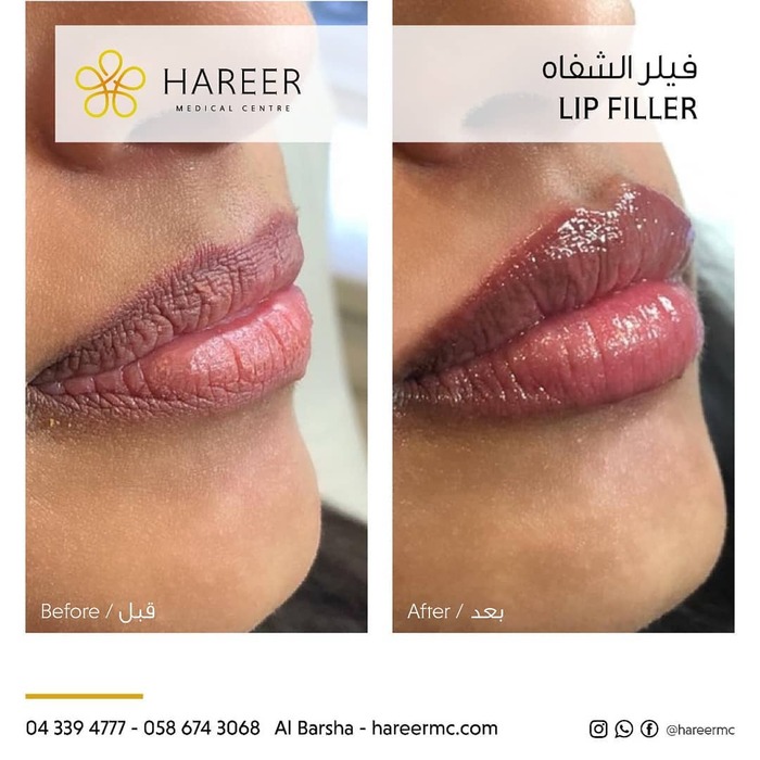  Hareer Medical Center of Hareer Dermatology Clinic The Iridium Building, Umm Suqeim St, Al Barsha, Al Barsha 1 - Photo 2 of 10