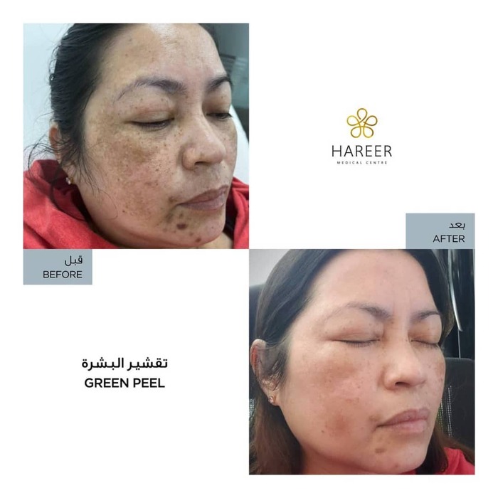  Hareer Medical Center of Hareer Dermatology Clinic The Iridium Building, Umm Suqeim St, Al Barsha, Al Barsha 1 - Photo 3 of 10