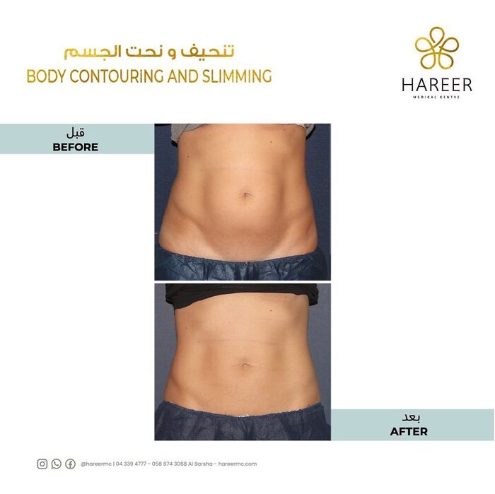  Hareer Medical Center of Hareer Dermatology Clinic The Iridium Building, Umm Suqeim St, Al Barsha, Al Barsha 1 - Photo 6 of 10