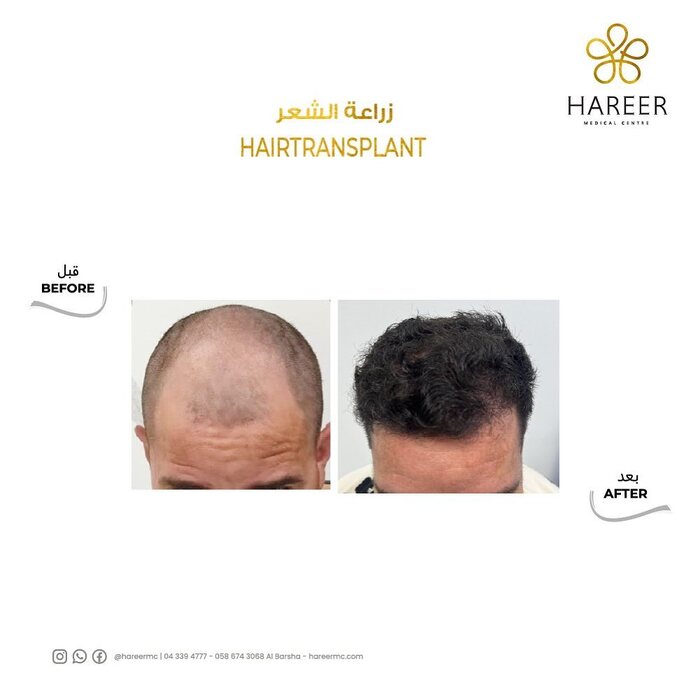  Hareer Medical Center of Hareer Dermatology Clinic The Iridium Building, Umm Suqeim St, Al Barsha, Al Barsha 1 - Photo 10 of 10
