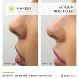  Hareer Dermatology Clinic The Iridium Building, Umm Suqeim St, Al Barsha, Al Barsha 1 
