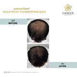  Hareer Dermatology Clinic The Iridium Building, Umm Suqeim St, Al Barsha, Al Barsha 1 
