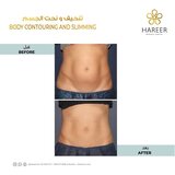  Hareer Dermatology Clinic The Iridium Building, Umm Suqeim St, Al Barsha, Al Barsha 1 