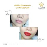  Hareer Dermatology Clinic The Iridium Building, Umm Suqeim St, Al Barsha, Al Barsha 1 