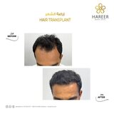  Hareer Dermatology Clinic The Iridium Building, Umm Suqeim St, Al Barsha, Al Barsha 1 