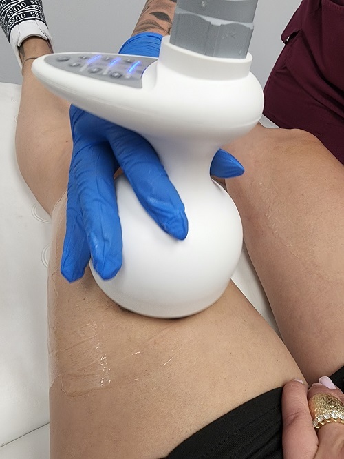  New Album of Canada MedLaser Newmarket 16655 Yonge Street, Unit 23 - Photo 2 of 3