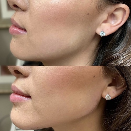  Profile Photos of LA Ageless Medical Aesthetics 420 South Beverly Drive, Suite 202 - Photo 2 of 4
