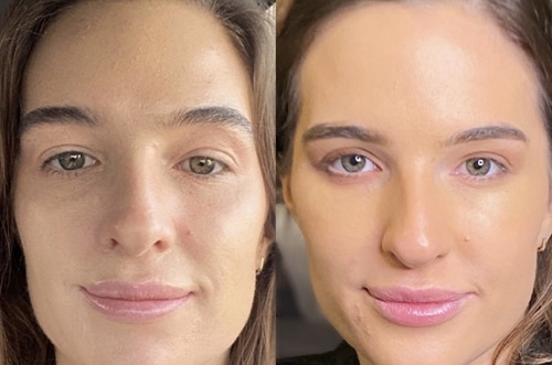  Profile Photos of LA Ageless Medical Aesthetics 420 South Beverly Drive, Suite 202 - Photo 3 of 4