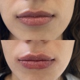  LA Ageless Medical Aesthetics 420 South Beverly Drive, Suite 202 