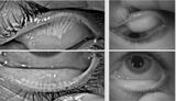  Dry Eye Directory 30 North Gould Street, 