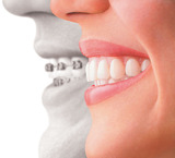 Menus & Prices, Invisalign Charlotte, Charlotte
