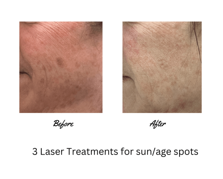  Profile Photos of SansAge Medical Aesthetics 117 Manchester Street, Unit 1 - Photo 4 of 4