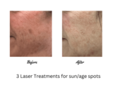 SansAge Medical Aesthetics, Concord