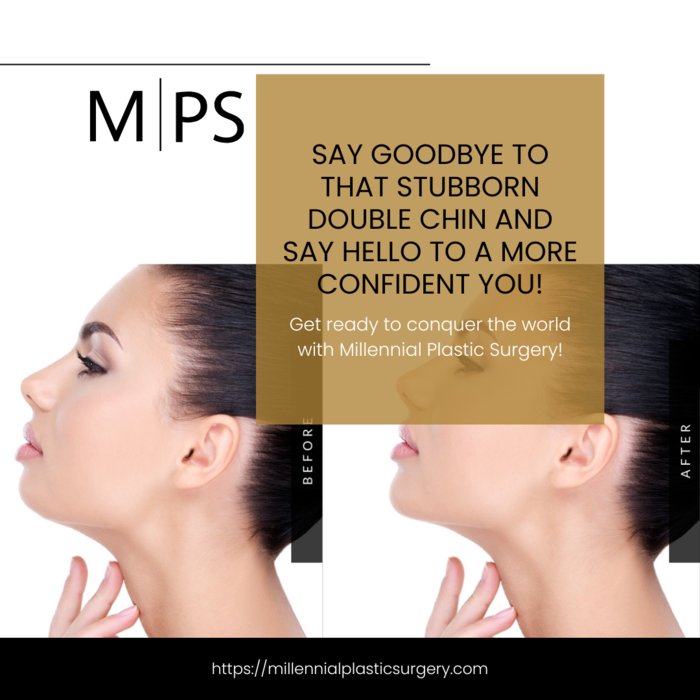  Millennial Plastic Surgery of Millennial Plastic Surgery 56 W 45th St, 4th floor - Photo 7 of 12