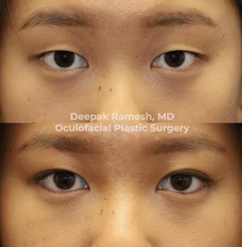  Profile Photos of The Center for Eye and Facial Plastic Surgery in Somerset - Dr. Deepak Ramesh 35 Clyde Road, #104 - Photo 1 of 2