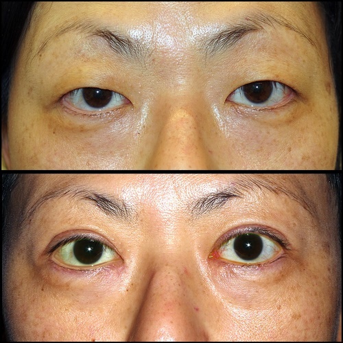  Profile Photos of The Center for Eye and Facial Plastic Surgery in Livingston - Dr. Deepak Ramesh 22 Old Short Hills Road, Suite 202 - Photo 3 of 3