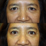  The Center for Eye and Facial Plastic Surgery in Livingston - Dr. Deepak Ramesh 22 Old Short Hills Road, Suite 202 