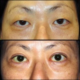  The Center for Eye and Facial Plastic Surgery in Livingston - Dr. Deepak Ramesh 22 Old Short Hills Road, Suite 202 