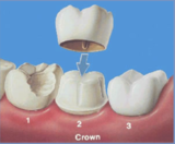 Beachwood Dental, Beachwood