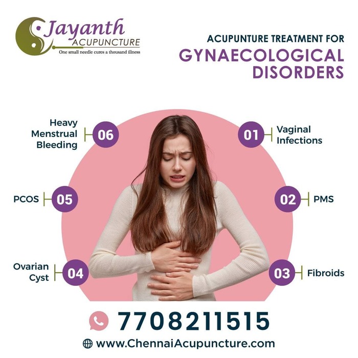 Acupuncture Treatment For Gynecological Disorders in Chennai Acupuncture Treatment in Annanagar of Chennai Jayanth Acupuncture Clinic Vasantham Colony, Annanagar, - Photo 17 of 27 Acupuncture Treatment For Gynecological Disorders in Chennai Acupuncture Treatment in Annanagar of Chennai Jayanth Acupuncture Clinic Vasantham Colony, Annanagar, - Photo 17 of 27