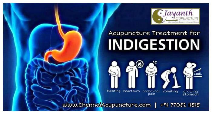 Acupuncture Treatment For Indigestion in Chennai Acupuncture Treatment in Annanagar of Chennai Jayanth Acupuncture Clinic Vasantham Colony, Annanagar, - Photo 1 of 27