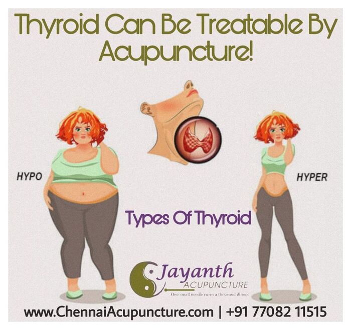Acupuncture Treatment For Thyroid in Chennai Acupuncture Treatment in Annanagar of Chennai Jayanth Acupuncture Clinic Vasantham Colony, Annanagar, - Photo 12 of 27