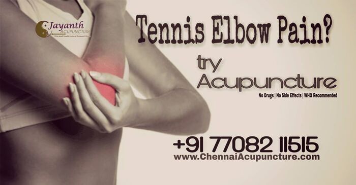 Acupuncture Treatment For Tennis Elbow in Chennai Acupuncture Treatment in Annanagar of Chennai Jayanth Acupuncture Clinic Vasantham Colony, Annanagar, - Photo 4 of 27