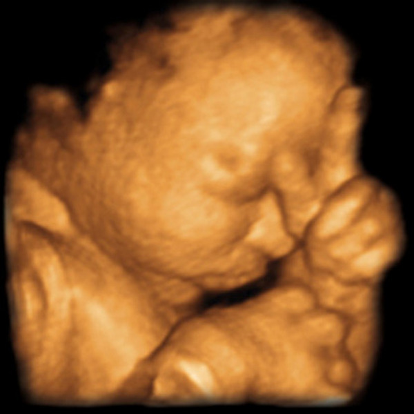  Profile Photos of Ultrasound Direct Croydon The Old Coach House, 2 Wellesley Court Road - Photo 2 of 3