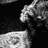Ultrasound Direct Glasgow, Glasgow
