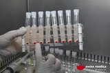 Multiple sclerosis research, Belgrade