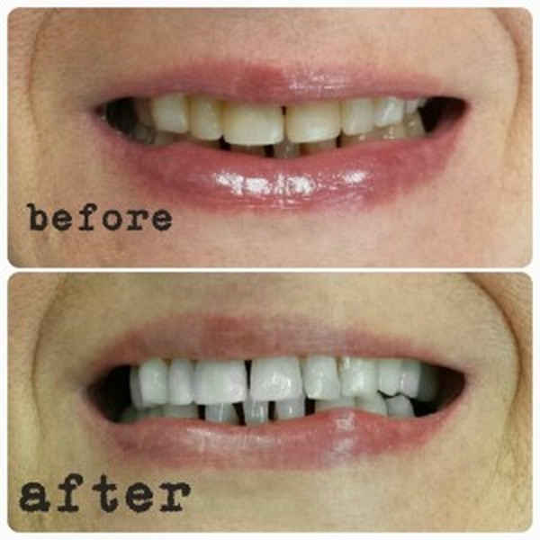  Profile Photos of Hsmile Teeth Whitening & Dental Hygiene 10376 Yonge Street, unit 202 - Photo 4 of 4