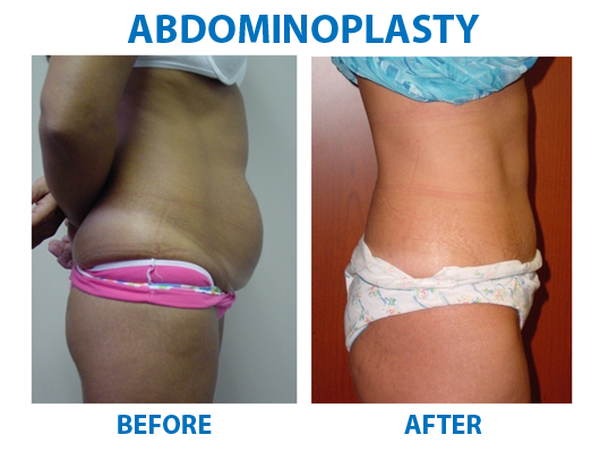  Profile Photos of Cosmetic Surgery in Delhi, India 2A/2, Taj Apartments Sector-12, R.K. Puram - Photo 2 of 7