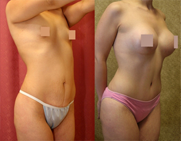  Profile Photos of Cosmetic Surgery in Delhi, India 2A/2, Taj Apartments Sector-12, R.K. Puram - Photo 4 of 7