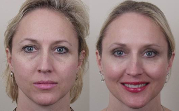  Profile Photos of Cosmetic Surgery in Delhi, India 2A/2, Taj Apartments Sector-12, R.K. Puram - Photo 5 of 7