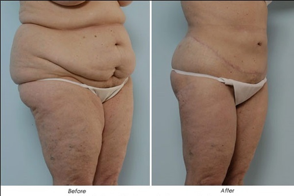  Profile Photos of Cosmetic Surgery in Delhi, India 2A/2, Taj Apartments Sector-12, R.K. Puram - Photo 6 of 7