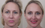 Cosmetic Surgery in Delhi, India, delhi
