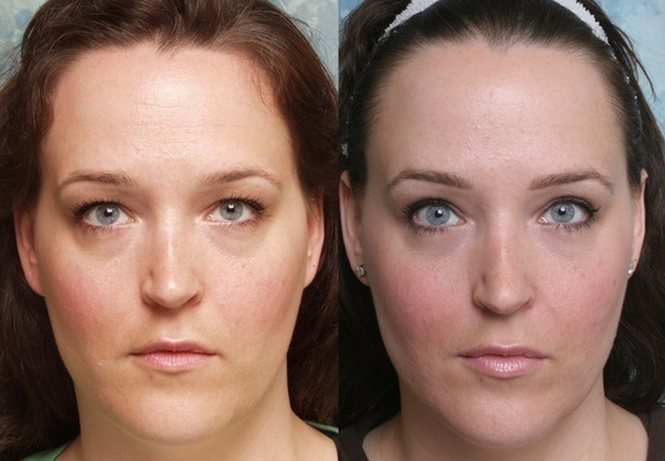  Profile Photos of Best Cosmetic Surgeon in Delhi NCR 2A/2 Taj Apartments, Rao Tula Ram Marg, R.K Puram, Sector-12 - Photo 1 of 9