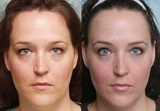  Best Cosmetic Surgeon in Delhi NCR 2A/2 Taj Apartments, Rao Tula Ram Marg, R.K Puram, Sector-12 