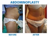  Best Cosmetic Surgeon in Delhi NCR 2A/2 Taj Apartments, Rao Tula Ram Marg, R.K Puram, Sector-12 