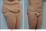  Best Cosmetic Surgeon in Delhi NCR 2A/2 Taj Apartments, Rao Tula Ram Marg, R.K Puram, Sector-12 