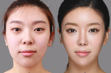  Best Cosmetic Surgeon in Delhi NCR 2A/2 Taj Apartments, Rao Tula Ram Marg, R.K Puram, Sector-12 