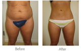 Best Cosmetic Surgeon in Delhi NCR, New Delhi